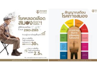 ‘ศูนย์โรคระบบประสาท -บำรุงราษฎร์ ” เผย “โรคหลอดเลือดสมอง” ภัยเงียบคร่าชีวิตคนไทยกว่า 30% แต่ช่วยชีวิตผู้ป่วย และรักษาได้ ด้วยเทคโนโลยีทันสมัย หากตรวจพบเร็ว ภายใน 270 นาที