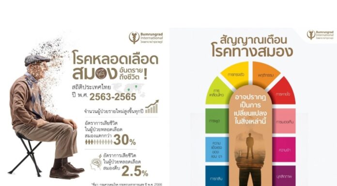 ‘ศูนย์โรคระบบประสาท -บำรุงราษฎร์ ” เผย “โรคหลอดเลือดสมอง” ภัยเงียบคร่าชีวิตคนไทยกว่า 30% แต่ช่วยชีวิตผู้ป่วย และรักษาได้ ด้วยเทคโนโลยีทันสมัย หากตรวจพบเร็ว ภายใน 270 นาที
