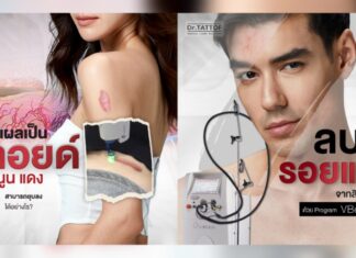 Dr.TATTOF ยกระดับการรักษาผิวด้วยเลเซอร์โปรแกรม VBeam เลเซอร์รักษารอยแดง สิวอักเสบ ปานแดง และคีลอยด์อย่างมีประสิทธิภาพ